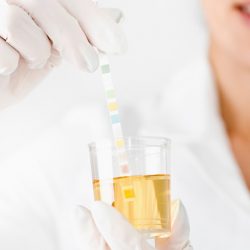 Pesquisadores no Japão identificam alergias alimentares através de testes de urina